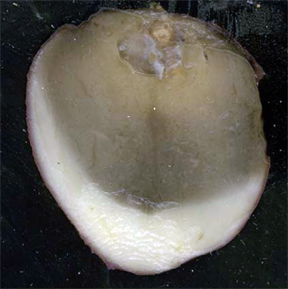 Dry rot lesion colonized by soft rot bacteria.