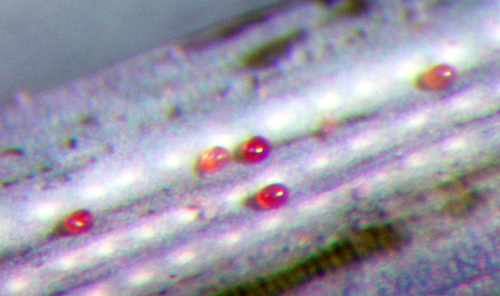 Eriophyid mite eggs