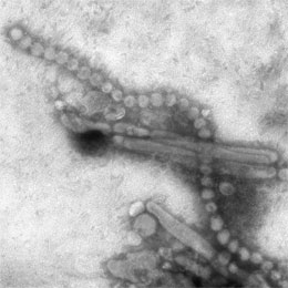  Influenza A (H7N9) as viewed through an electron microscope. Both filaments and spheres are observed in this photo.